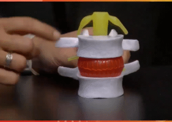 El malestar silencioso de la vida moderna: el dolor lumbar y cervical