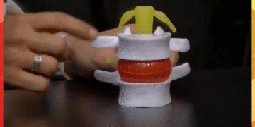 El malestar silencioso de la vida moderna: el dolor lumbar y cervical